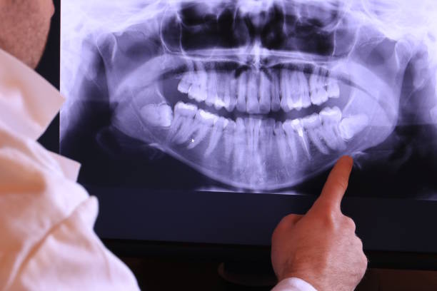 Best Emergency Denture Repair in Bryn Athyn, PA